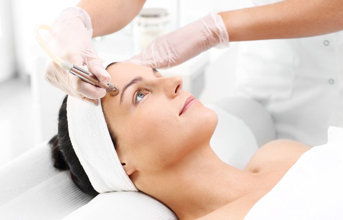 Microdermabrasion